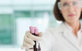 Kako odrediti rak pomoću testova?